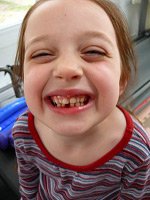 5 year old first lost tooth chickeymonkey